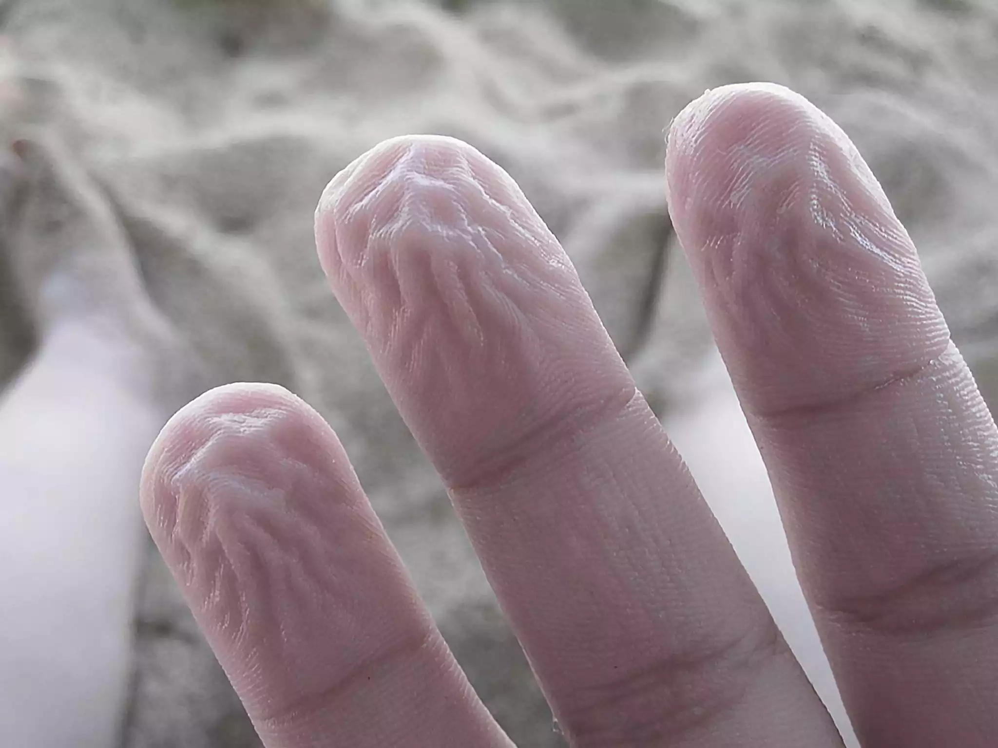 لماذا يتجعد جلد الانسان عندما يمكث مده طويله في الماء