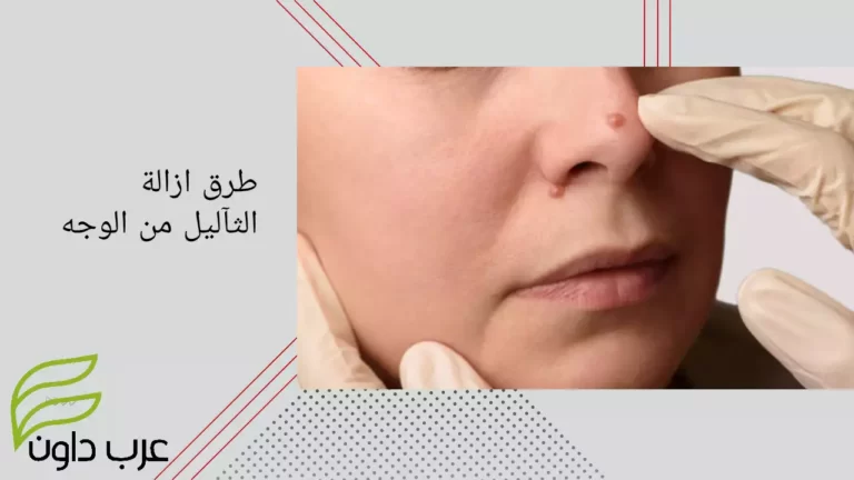 طرق ازالة الثآليل من الوجه